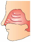 鼻の疾患 鼻の疾患